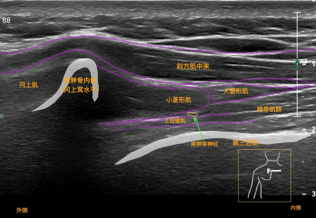 1753948715131541.png 1749695870452389.png