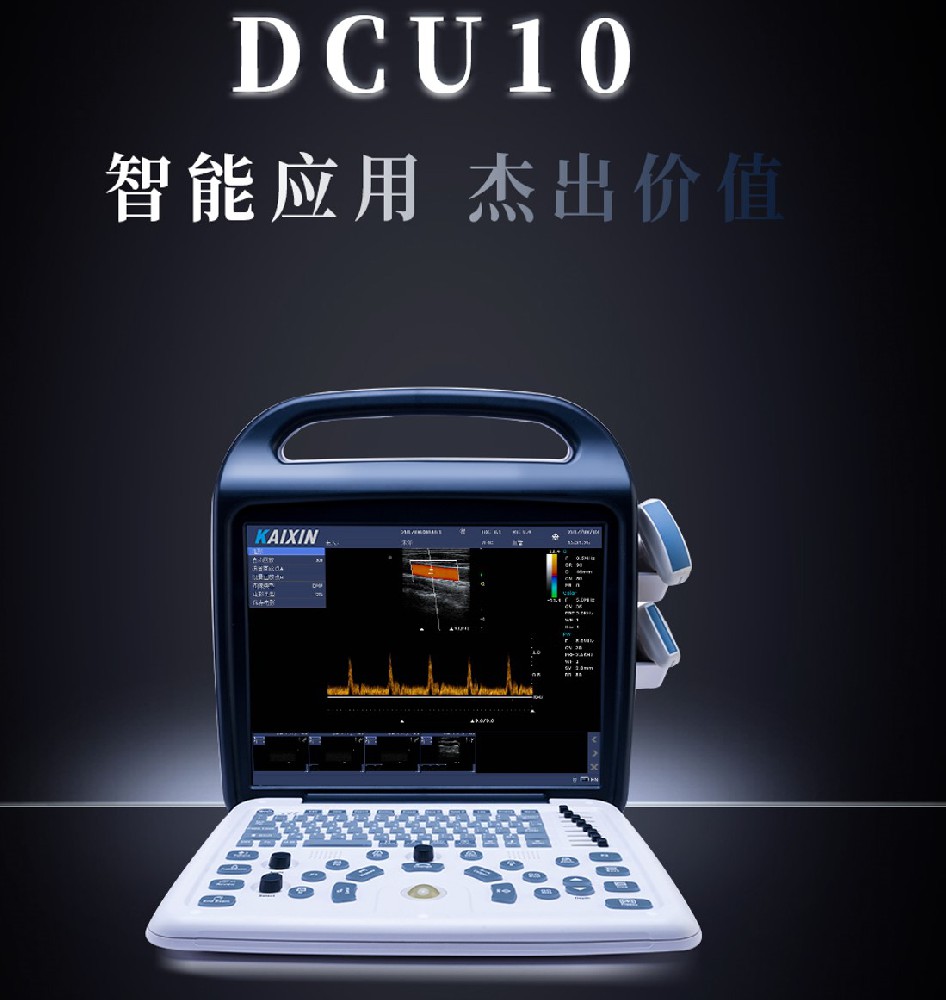 凯信彩超—床旁常规诊室全覆盖及可开展检查项目
