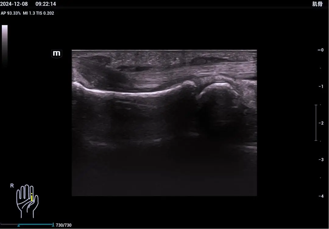 关于肌骨超声的介绍